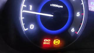 ABS light issue Hyundai Verna Car abs sensor faulty