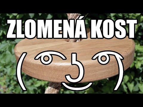 Video: Vykĺbenie Akromiálneho Konca Klavikuly