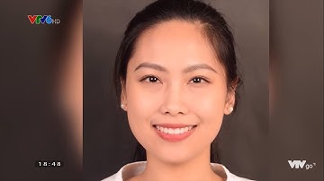 Xu hướng Niềng răng Invisalign ở giới trẻ