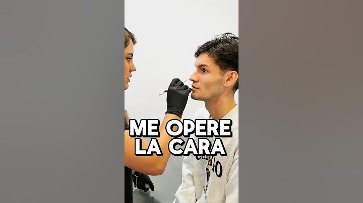 ME OPERÉ LA CARA Y ESTE ES MI NUEVO YO… #asmr #shorts #asmrvideo