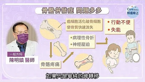 乳癌容易骨轉移，積極治療避免失能 - 天天要聞