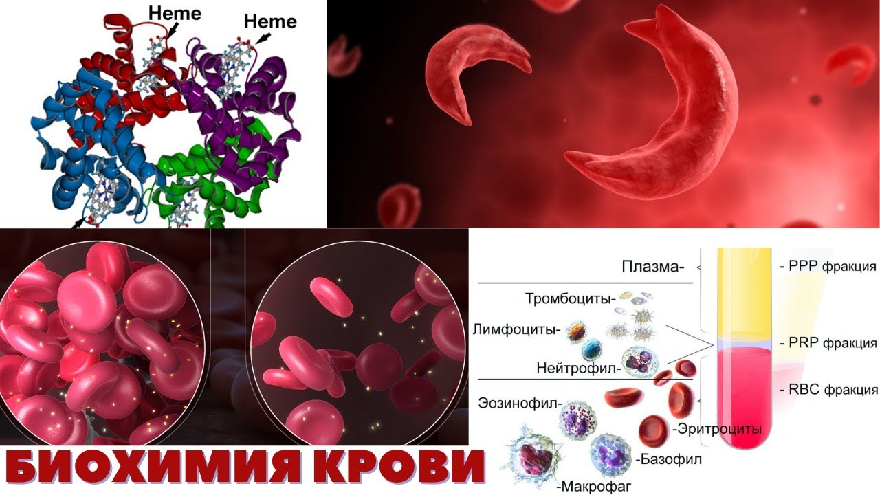 Анемия биохимия. Клетки крови биохимия. Биохимия эритроцитов. Биохимический крови лекция.