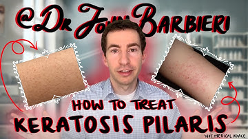 How to treat small pimple bumps on the arms – Dermatologist explains keratosis pilaris