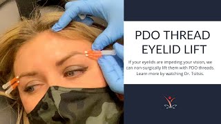 NonSurgical Eyelid Lift with PDO Threads