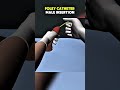 Foley Catheter Insertion In Male|3D ANIMATIONS| #FoleyCatheter#FoleyCatheterInsertion#fyp