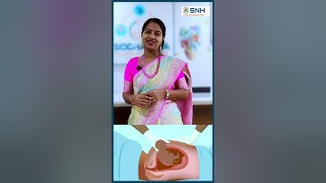 Ever wonder why C-sections are increased these days?