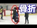 [事故] 弟がトリプルアクセルをして骨折しました