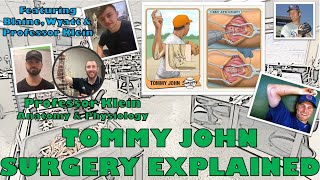 Tommy John Surgery Explained Tommy John Surgery Explained Michael Redler Md