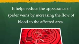 Spider Veins Natural Treatment - Apple Cider Vinegar