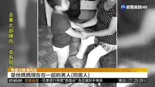 4歲男童腿部瘀青 疑遭母親同居人虐打| 華視新聞 20180925