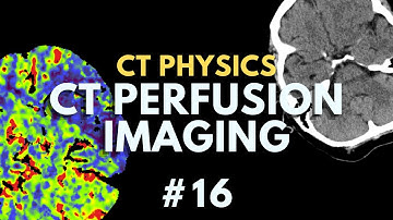 CT Perfusion Imaging Explained | TTP, CBV, CBF, MTT, Tmax | CT Radiology Physics Course #16