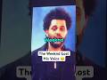 The Weeknd Lost His Voice