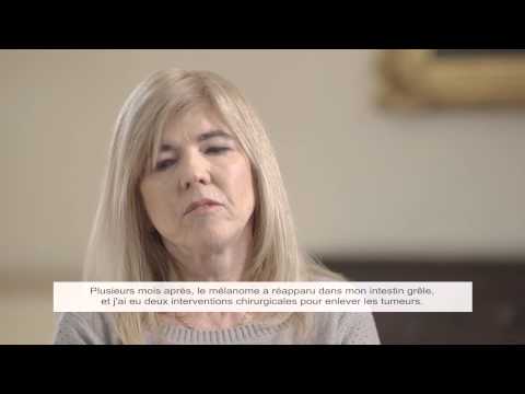 Melanoma Patient Experience