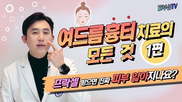 여드름 흉터치료의 모든것 1편_ 피부과전문의가 알려드립니다_ 피부심