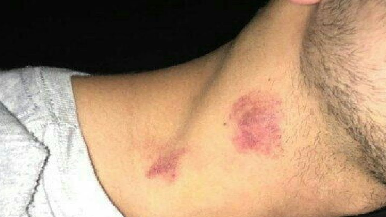 how to give someone a hickey on the neck for the first time - YouTube