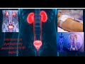 😱#intravenous pyelography procedure Hindi | #Ivp special | 🏥#intravenous #pyelography #urugram #ivu