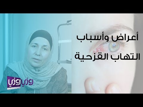 أعراض وأسباب التهاب قزحية العين والعلاجات المقترحة