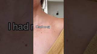 A swollen lymph node. Something so small I almost ignored it—until it led to my cancer diagnosis.