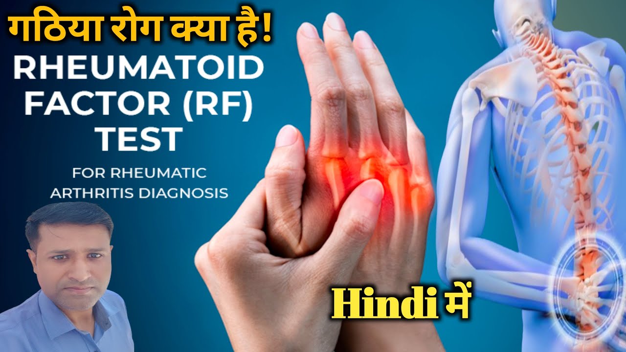 RA Factor टेस्ट क्या होता है | RA Factor पॉजिटिव का क्या इलाज है | RA Factor Normal Range क्या है |