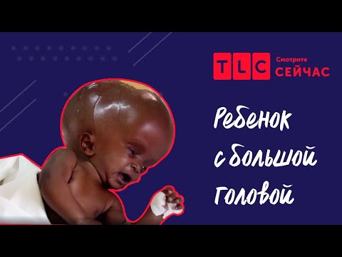 Мультфильм с большой головой