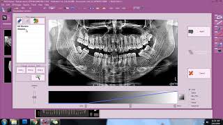 Insights Diagnostic - iRys Software Tutorial Video - 2D Image Enhancement Net Worth