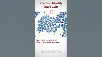 Can you identify these Cells In Body Fluid ? 🧐🙄🤔 #Quiz 422