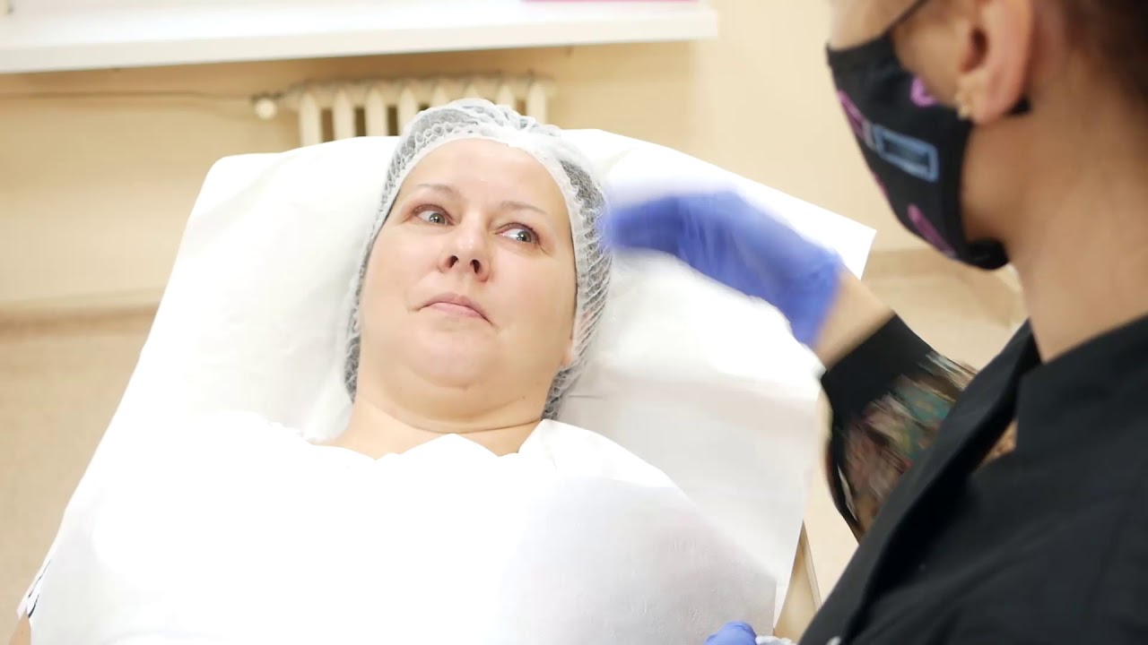 Karboksyterapia - lifting oka