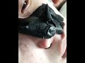 Product review of Urban Gabru charcoal black peel off mask.....👍or👎 #charcoalpeeloffmask #whiteheads