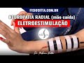 NEUROPATIA NERVO RADIAL ELETROESTIMULAÇÃO NEUROMUSCULAR Clínica de Fisioterapia Dr. Robson Sitta