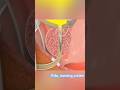 Urinary catheterization 3d animation #nursing#medico#ytshorts#nurse#medicosstuff#healthcare #viral