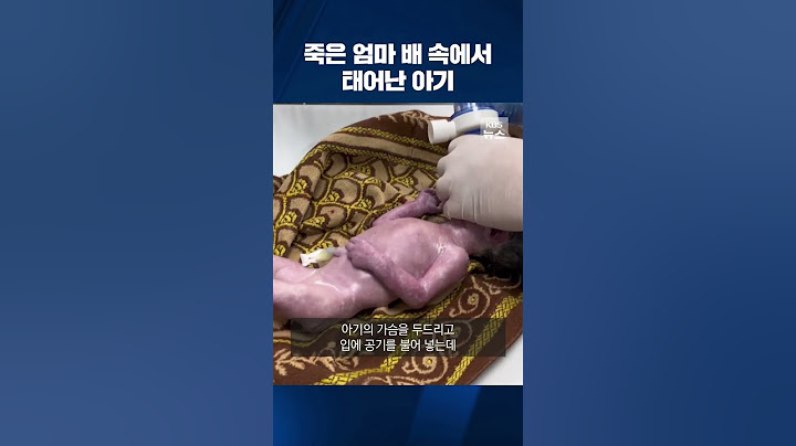 숨진 엄마 배 속에서 아기 살려낸 가자지구 의료진 #shorts / KBS