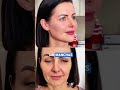 Elimina Manchas, Arrugas y Ojeras con Esta Mascarilla Casera