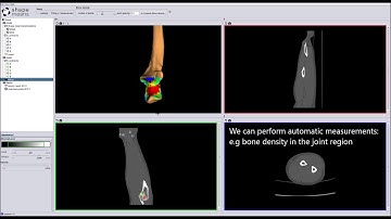 Interactive segmentation and measurement