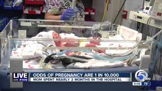 Mother Gives Birth To Rare Twins Born Holding Hands   Miracles Video