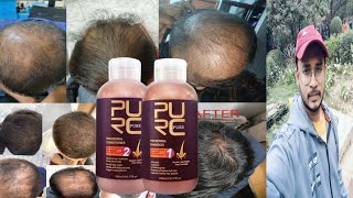 Purc Hair Growth Shampoo & Conditioner Honest Review