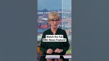 BBC News: Revolutionizing Fracture Treatments with Virtual Reality