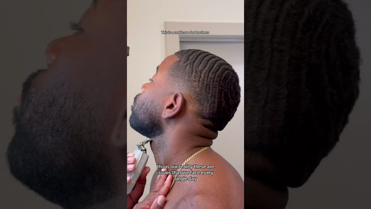 INGROWN HAIR ISSUES FOR BLACK MEN 