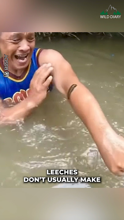Leeches | They Are Not Bat At All