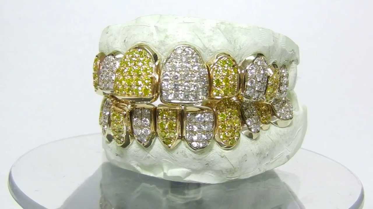 Yellow × White Diamond 7ct GRILLZ www.grillzjewelz.jp YouTube