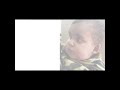 Calcarea carb ka bacha #constitution #shortvideo