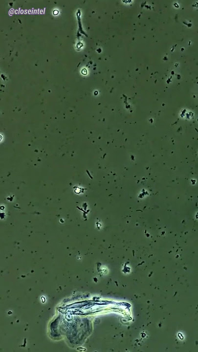 Mouthwash vs Germs Under Microscope (Listerine)
