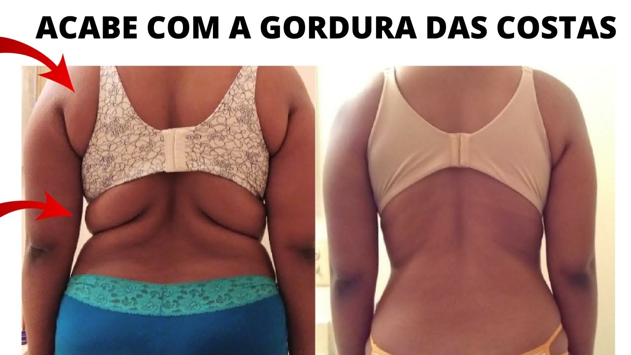 Exerc cios Para Perder Gordura Nas Costas Em Casa TML Totalmente Leve YouTube