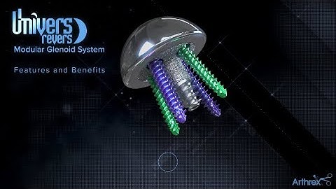 Univers Revers™ Modular Glenoid System Features and Benefits