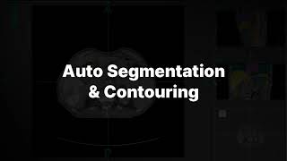 Auto segmentation and contouring - OncoField Lab