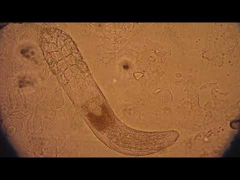 Demodex folliculorum Mite Walking