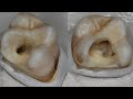 Endodontic series, Part 1: Access opening