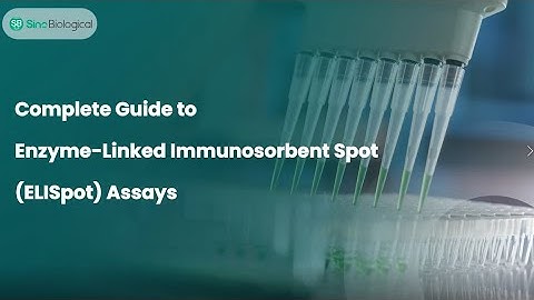 A Step-by-Step Guide to ELISpot Assays