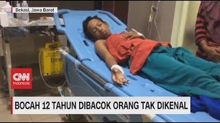 Bocah 12 Tahun Dibacok Orang Tak Dikenal