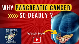 WHY PANCREATIC CANCER SO DEADLY?