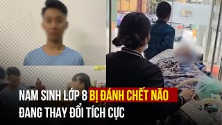 Sức khỏe nam sinh lớp 8 bị đánh chết não thay đổi tích cực